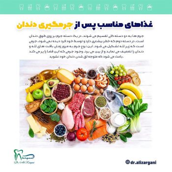 غذاهای مناسب پس از جرمگیری دندان