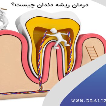 دکتر علی زرگانی | دندانپزشک زیبایی فرمانیه | جراح دندانپزشک تهران