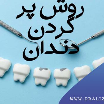 دکتر علی زرگانی | دندانپزشک زیبایی فرمانیه | جراح دندانپزشک تهران