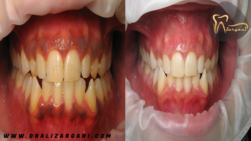 دکتر علی زرگانی | دندانپزشک زیبایی فرمانیه | جراح دندانپزشک تهران