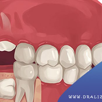  دکتر علی زرگانی | بهترین دندانپزشک ترمیمی و زیبایی در تهران