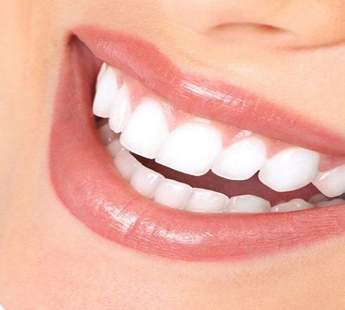 کامپوزیت ونیر دندان: لبخندی زیبا با دکتر علی زرگانی